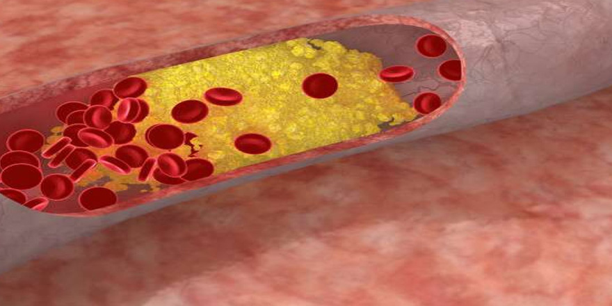 Kolesterol Nedir?